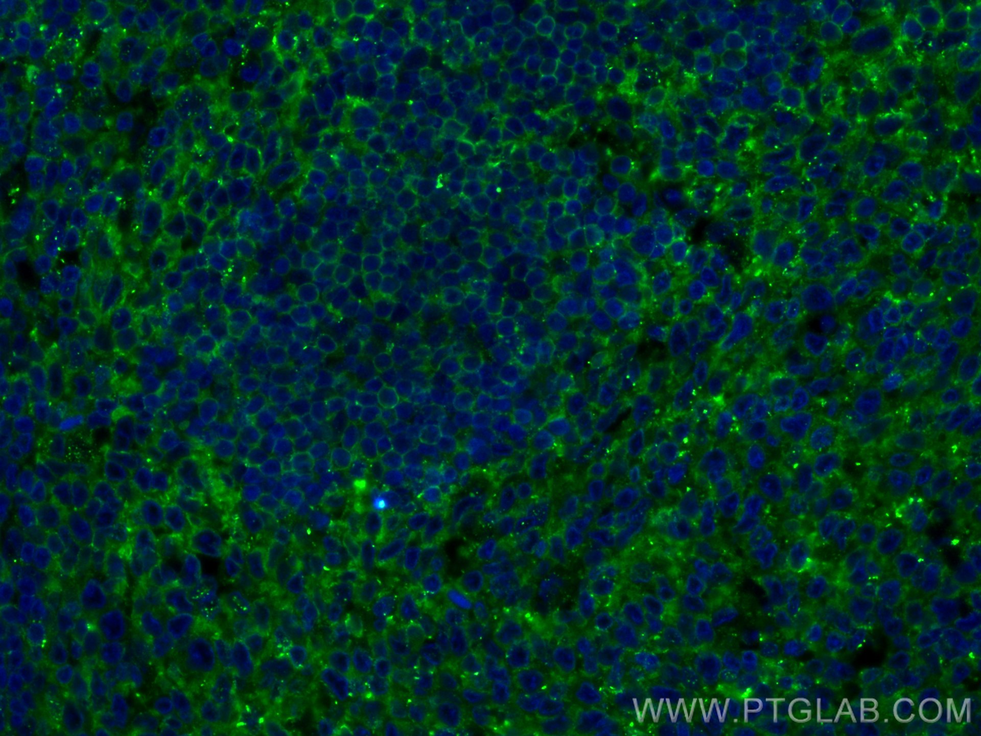 Immunofluorescence (IF) / fluorescent staining of human tonsillitis tissue using CD5 Polyclonal antibody (17227-1-AP)