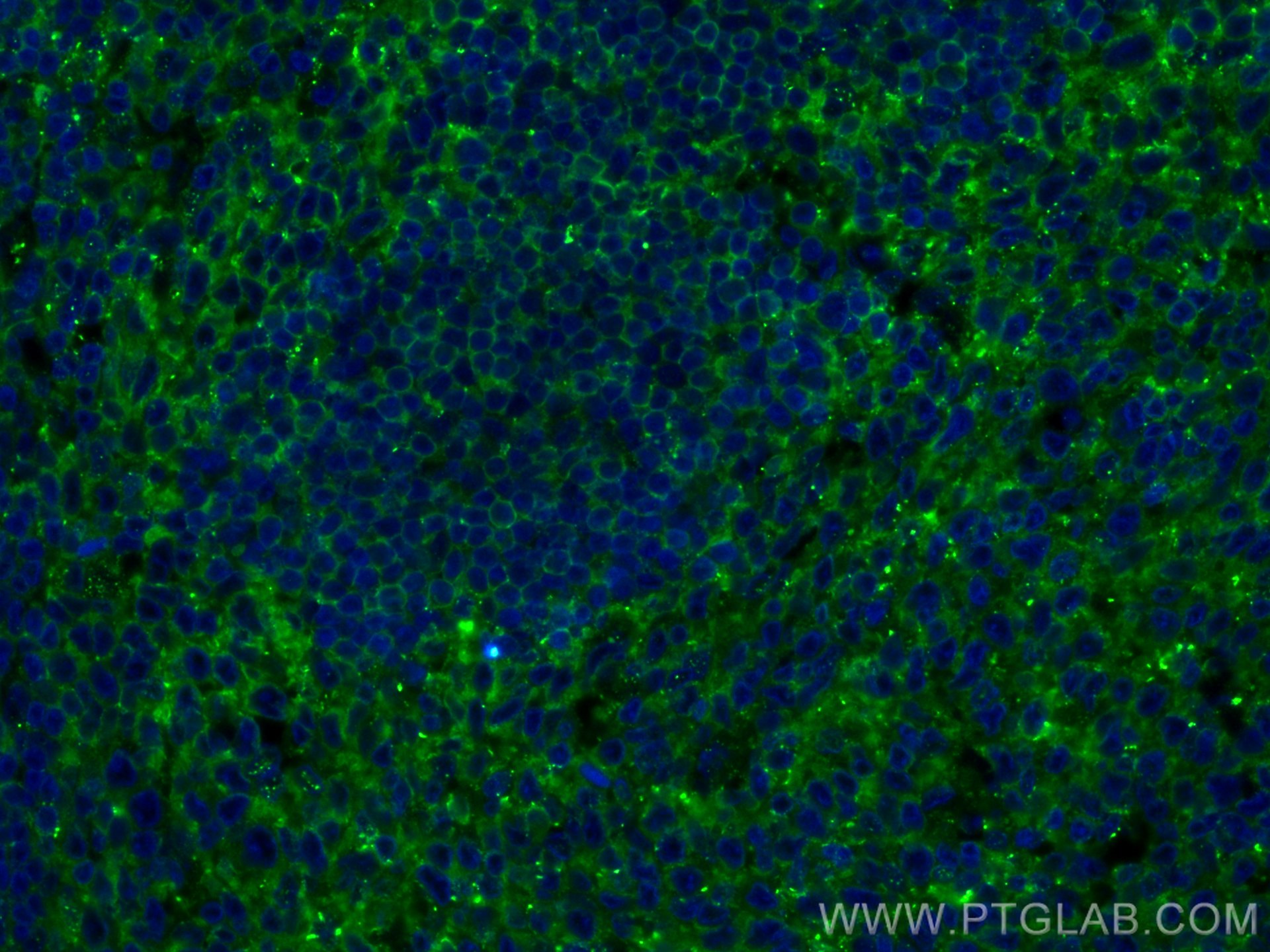 Immunofluorescence (IF) / fluorescent staining of human tonsillitis tissue using CD5 Polyclonal antibody (17227-1-AP)