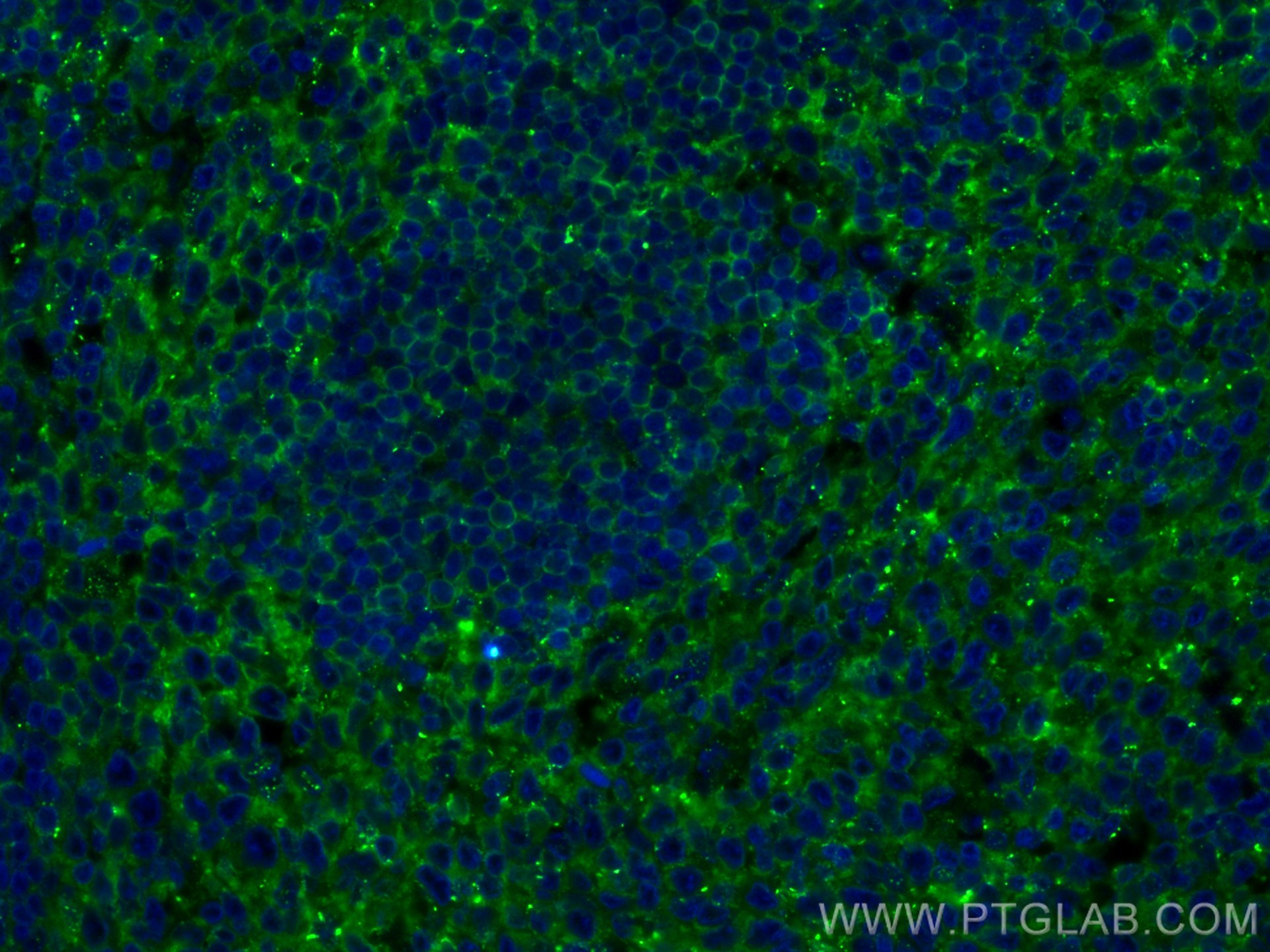 IF Staining of human tonsillitis using 17227-1-AP