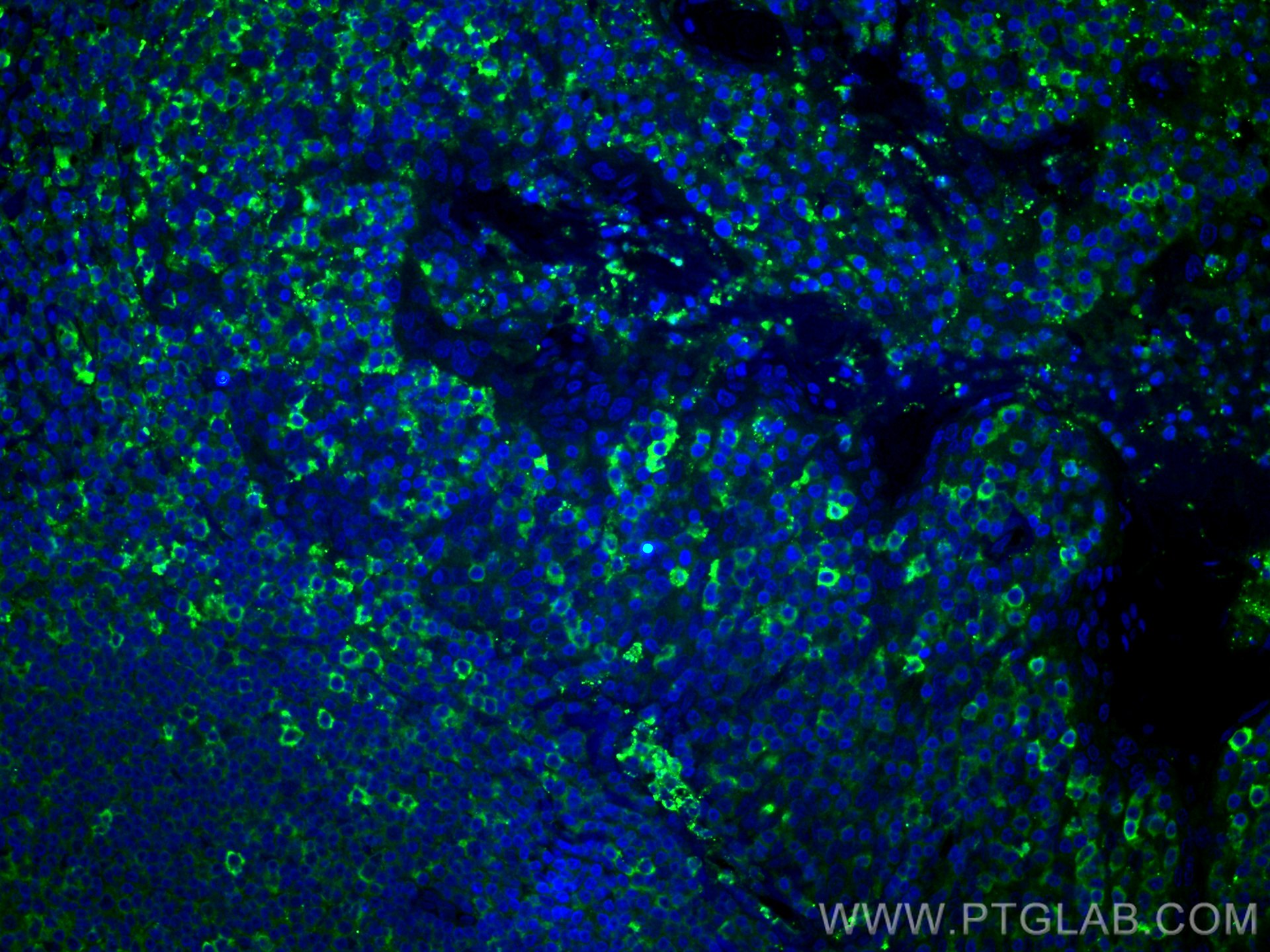 Immunofluorescence (IF) / fluorescent staining of human tonsillitis tissue using CD5 Polyclonal antibody (17227-1-AP)