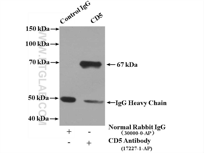 Immunoprecipitation (IP) experiment of mouse liver tissue using CD5 Polyclonal antibody (17227-1-AP)