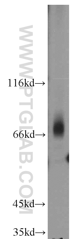 Western Blot (WB) analysis of Jurkat cells using CD5 Polyclonal antibody (17227-1-AP)