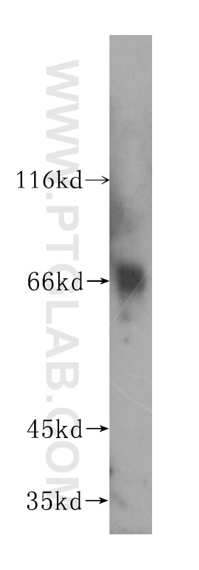 Western Blot (WB) analysis of mouse liver tissue using CD5 Polyclonal antibody (17227-1-AP)
