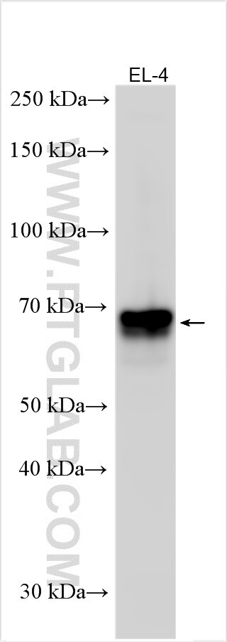 Western Blot (WB) analysis of various lysates using CD5 Polyclonal antibody (31249-1-AP)