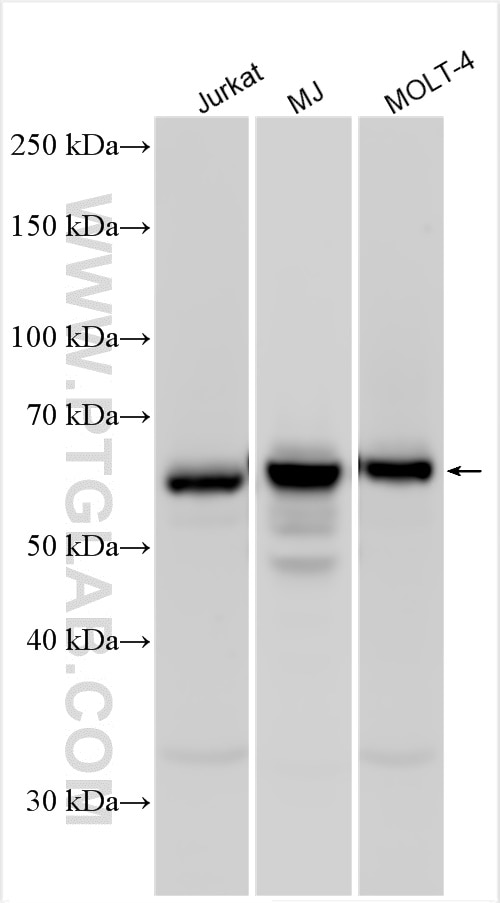 Western Blot (WB) analysis of various lysates using CD5 Polyclonal antibody (31502-1-AP)