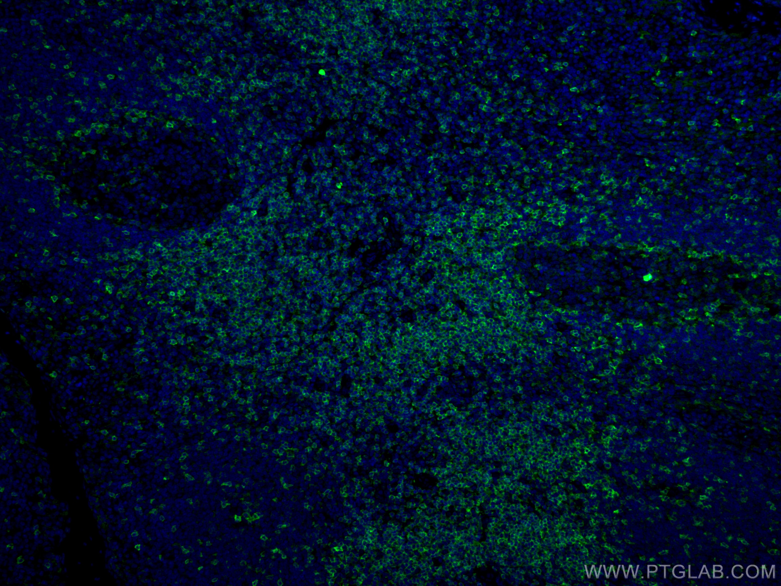 Immunofluorescence (IF) / fluorescent staining of human tonsillitis tissue using CD5 Monoclonal antibody (67278-1-Ig)