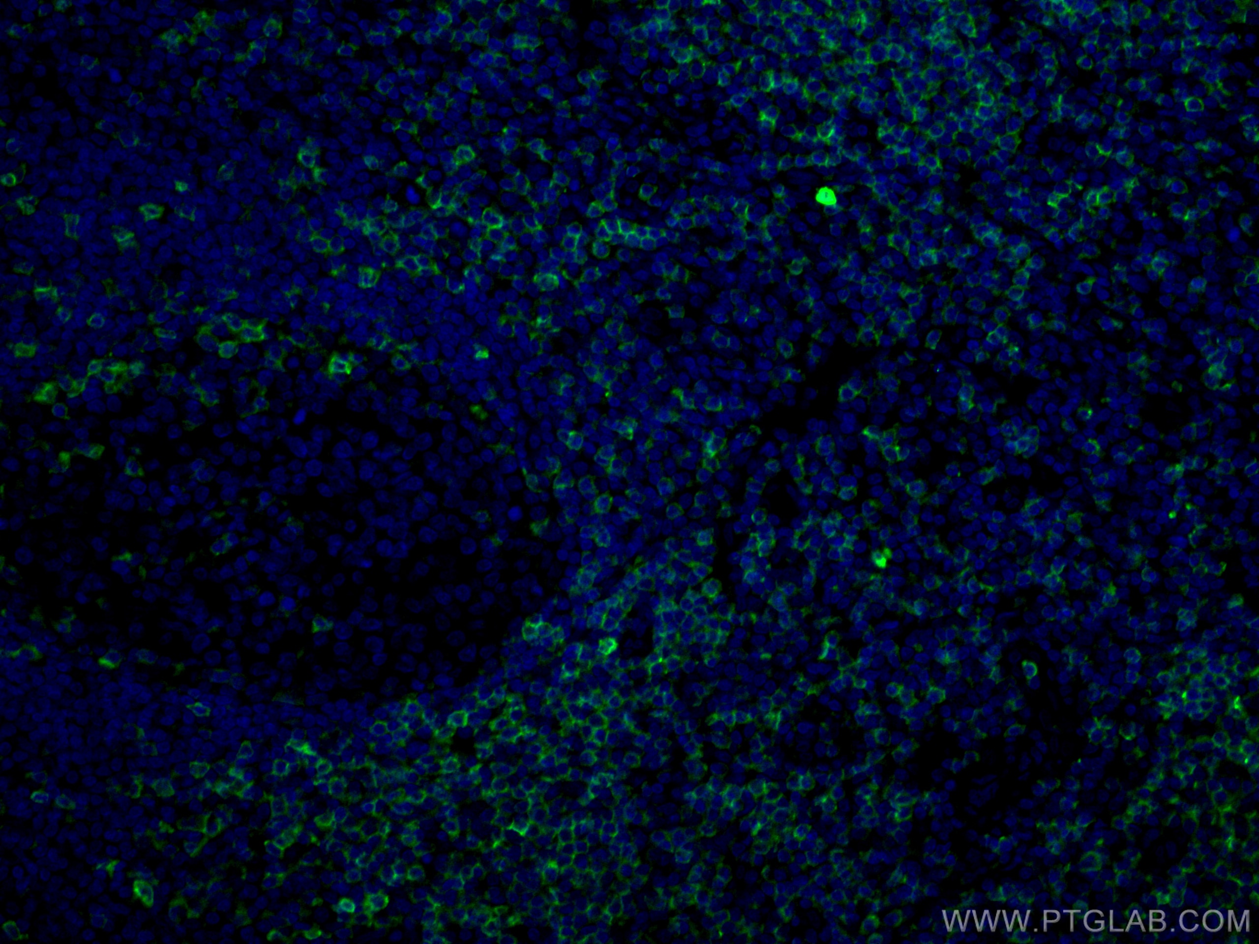 Immunofluorescence (IF) / fluorescent staining of human tonsillitis tissue using CD5 Monoclonal antibody (67278-1-Ig)