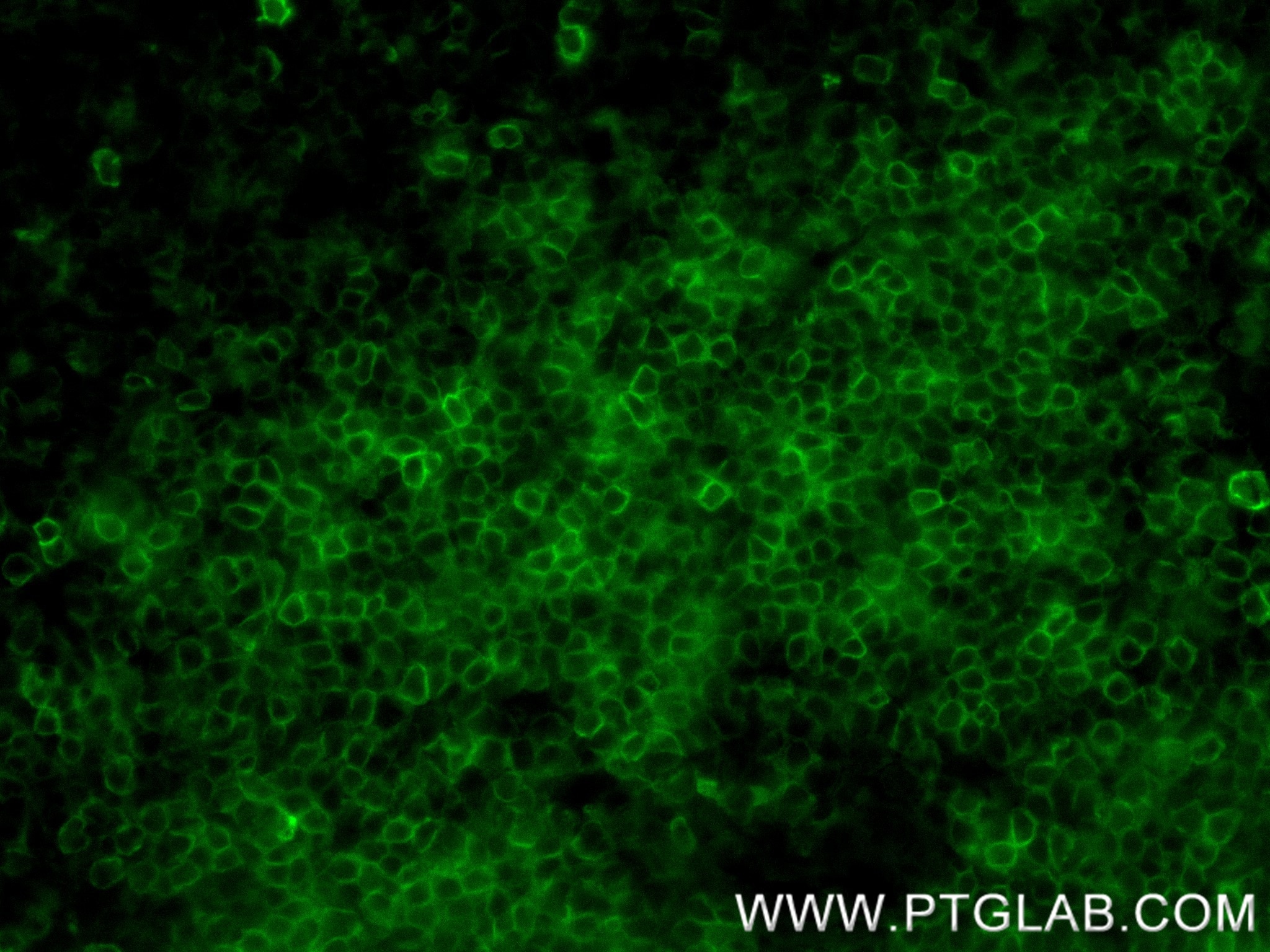 Immunofluorescence (IF) / fluorescent staining of mouse spleen tissue using CD5 Recombinant antibody (83451-4-RR)