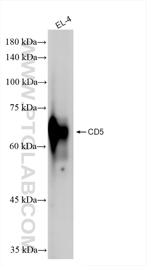 Western Blot (WB) analysis of EL-4 cells using CD5 Recombinant antibody (83451-4-RR)