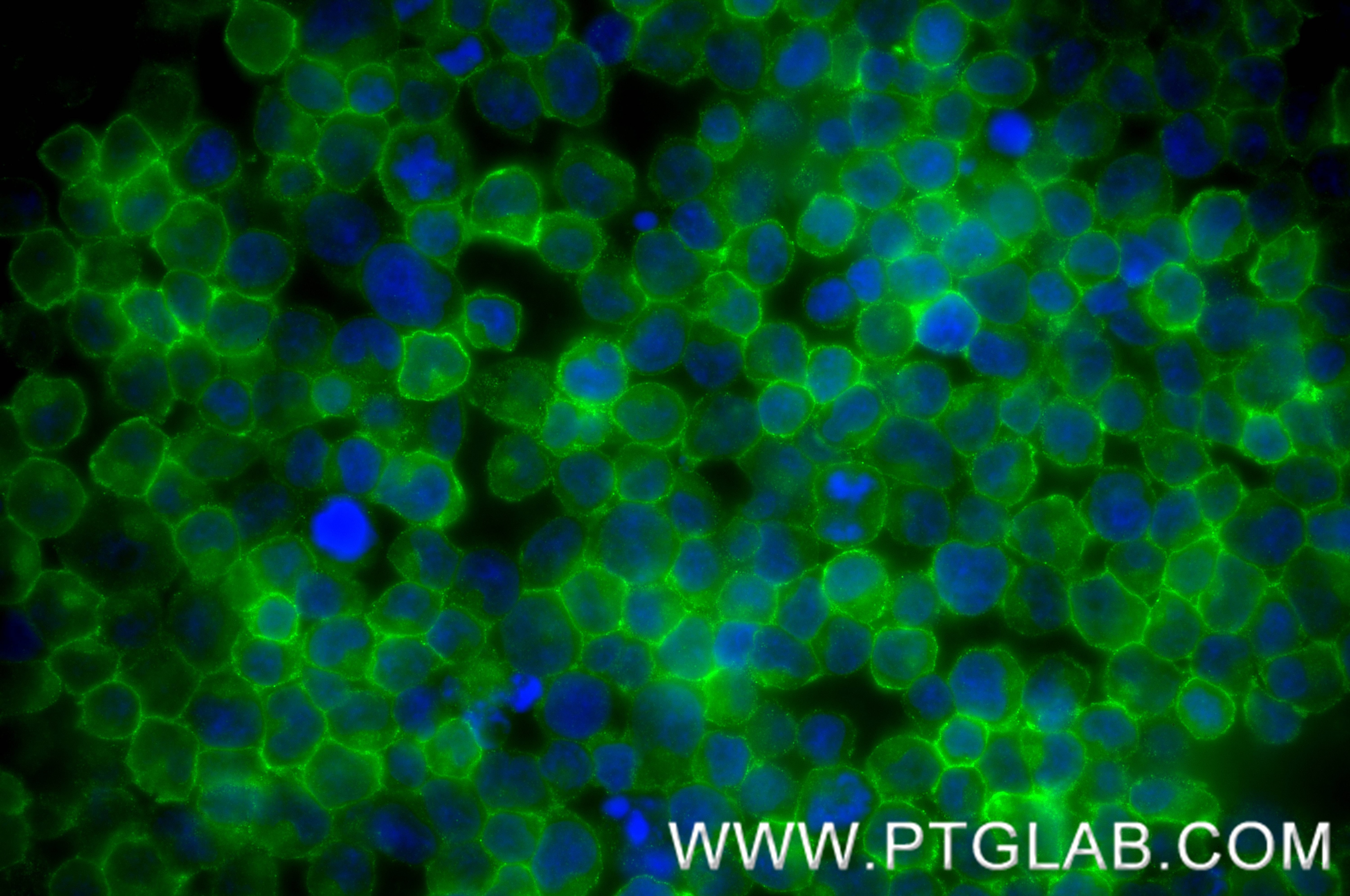 Immunofluorescence (IF) / fluorescent staining of Jurkat cells using CD5 Recombinant monoclonal antibody (83543-7-RR)