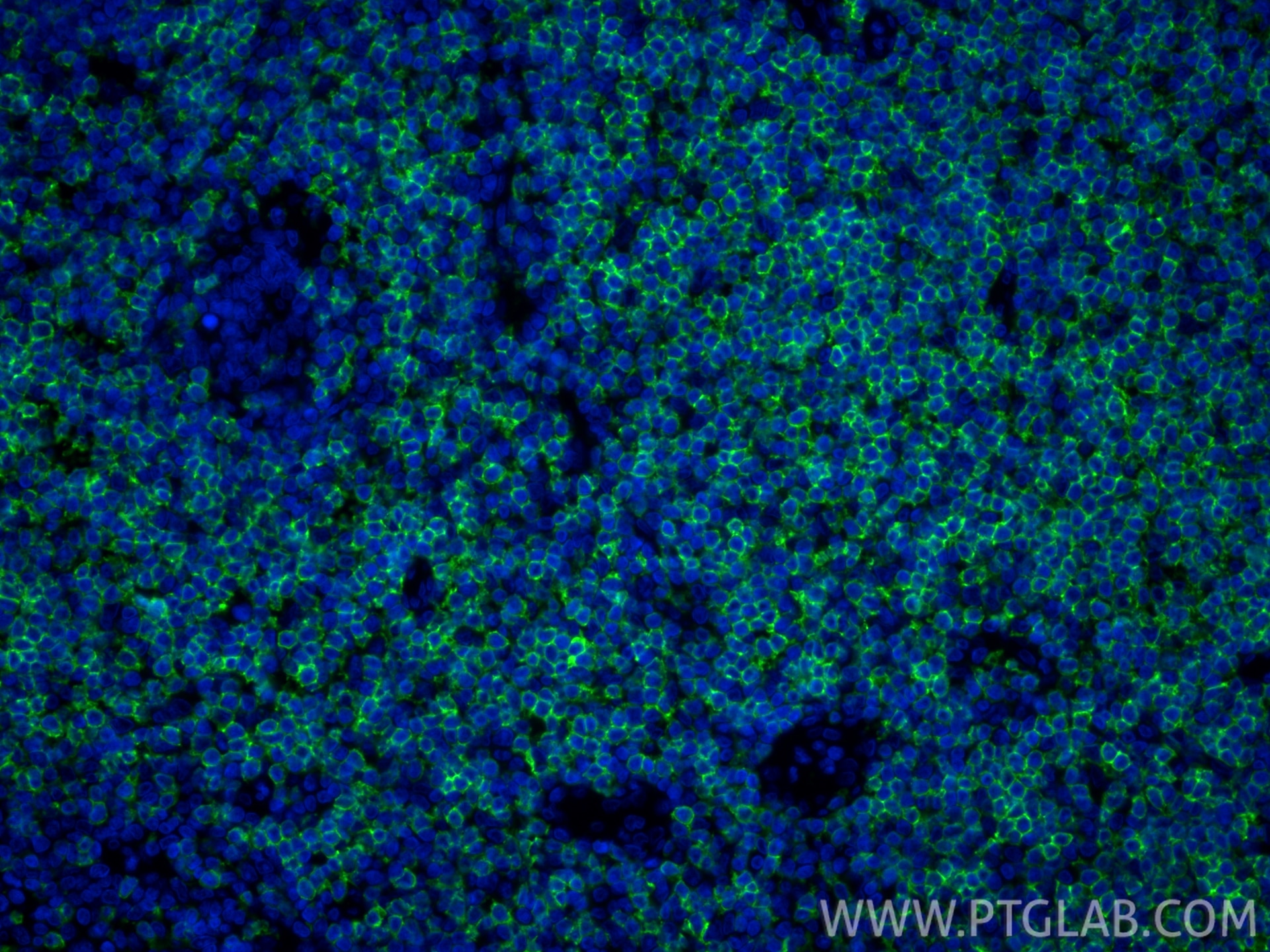 IF Staining of human tonsillitis using 83543-7-RR Immunofluorescence (IF) / fluorescent staining of human tonsillitis tissue using CD5 Recombinant monoclonal antibody (83543-7-RR)