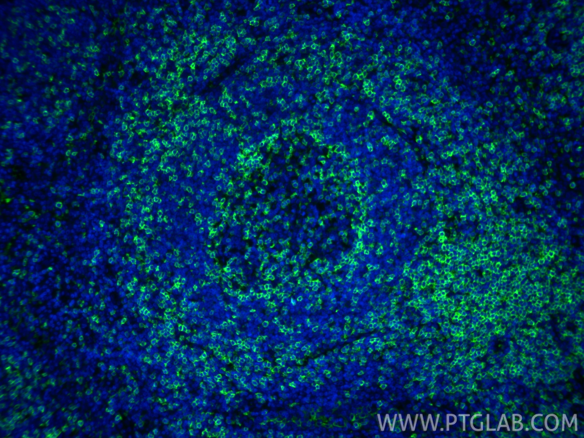 IF Staining of human tonsillitis using 83543-7-RR Immunofluorescence (IF) / fluorescent staining of human tonsillitis tissue using CD5 Recombinant monoclonal antibody (83543-7-RR)