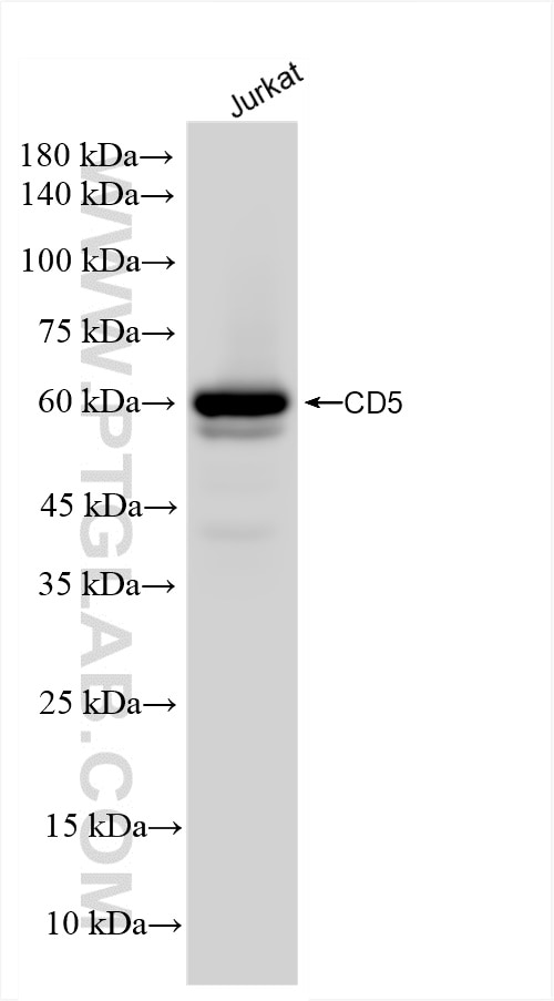 Western Blot (WB) analysis of Jurkat cells using CD5 Recombinant antibody (83543-7-RR)