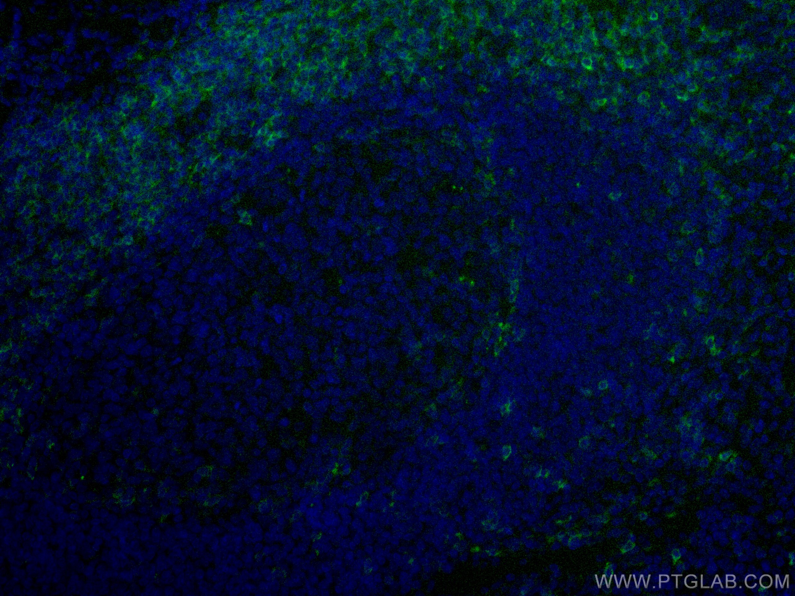 Immunofluorescence (IF) / fluorescent staining of human tonsillitis tissue using CoraLite® Plus 488-conjugated CD5 Monoclonal antib (CL488-67278)