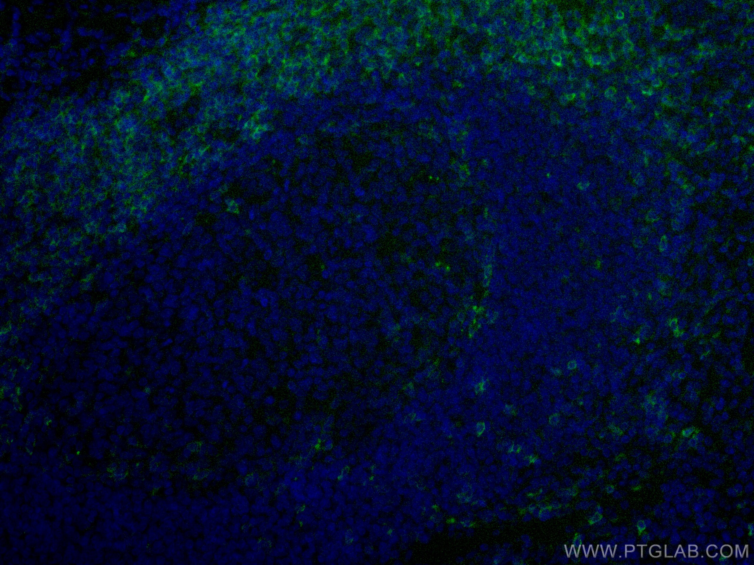 IF Staining of human tonsillitis using CL488-67278