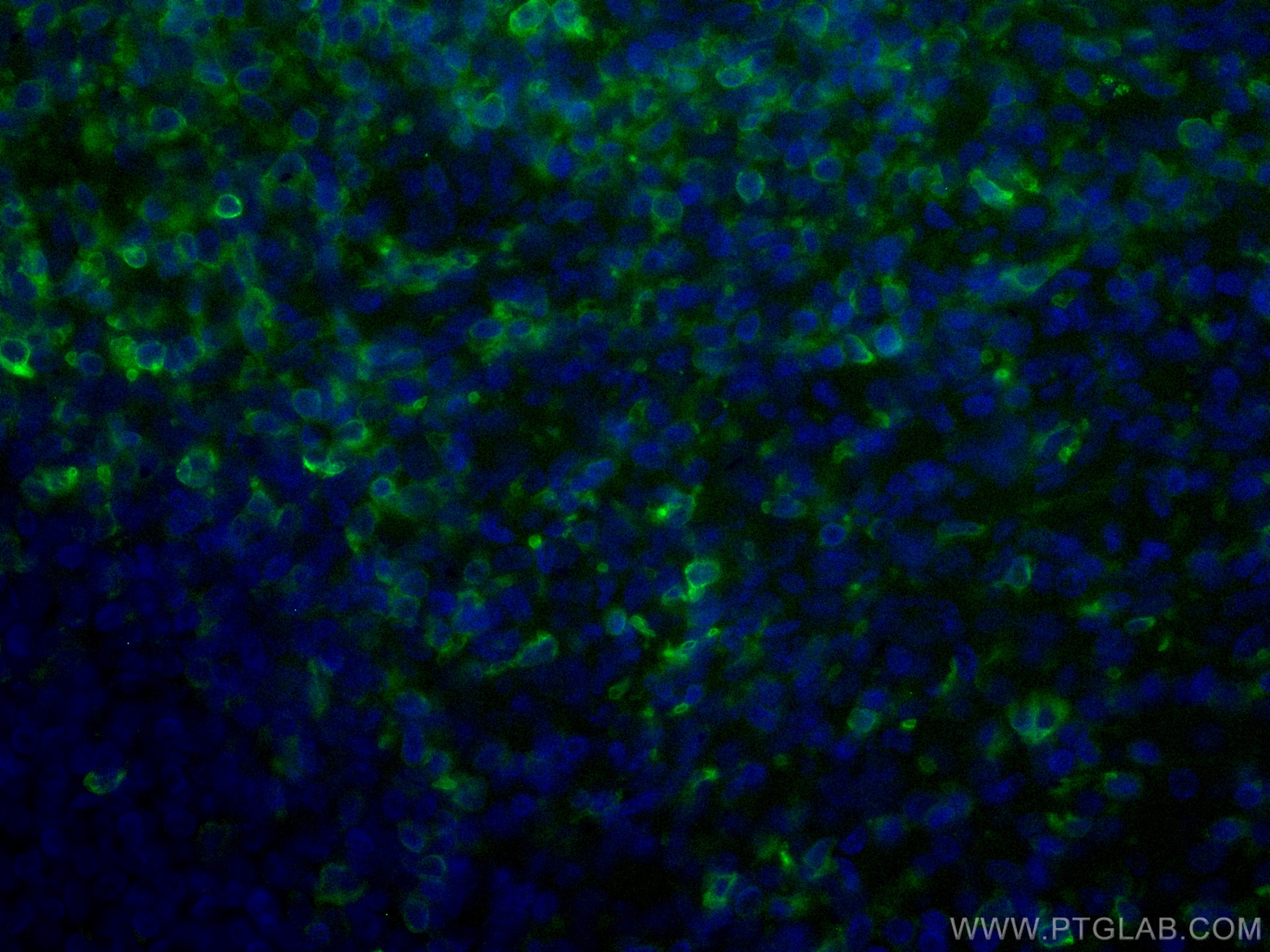 Immunofluorescence (IF) / fluorescent staining of human tonsillitis tissue using CoraLite® Plus 488-conjugated CD5 Monoclonal antib (CL488-67278)