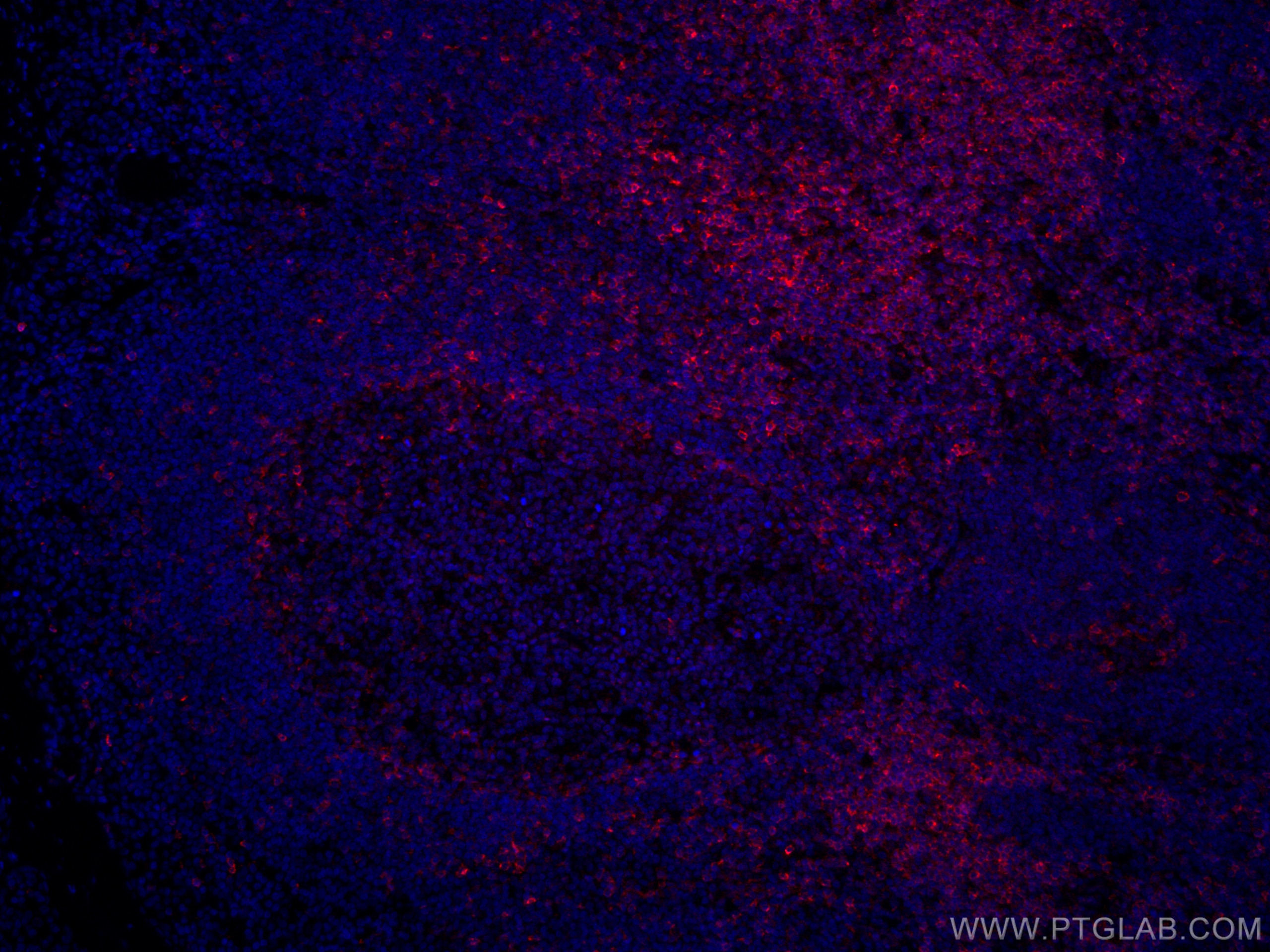 Immunofluorescence (IF) / fluorescent staining of human tonsillitis tissue using CoraLite®594-conjugated CD5 Monoclonal antibody (CL594-67278)