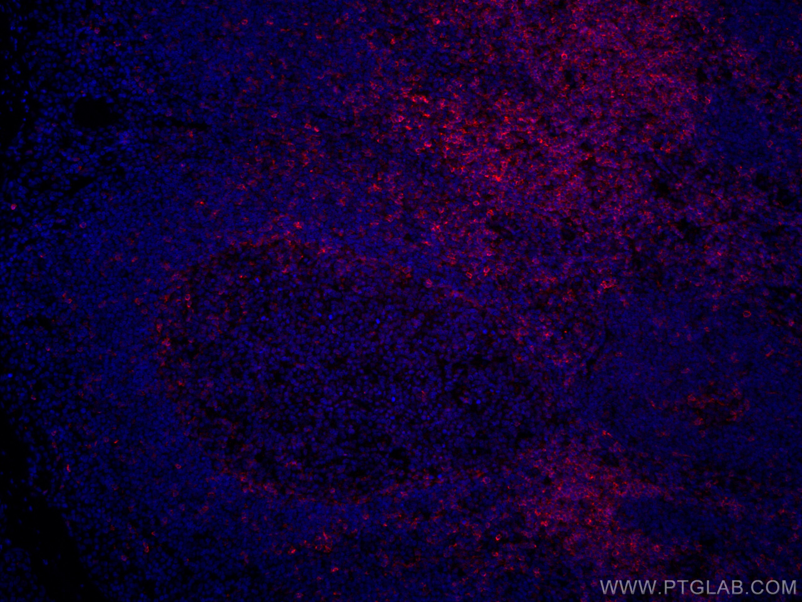 Immunofluorescence (IF) / fluorescent staining of human tonsillitis tissue using CoraLite®594-conjugated CD5 Monoclonal antibody (CL594-67278)