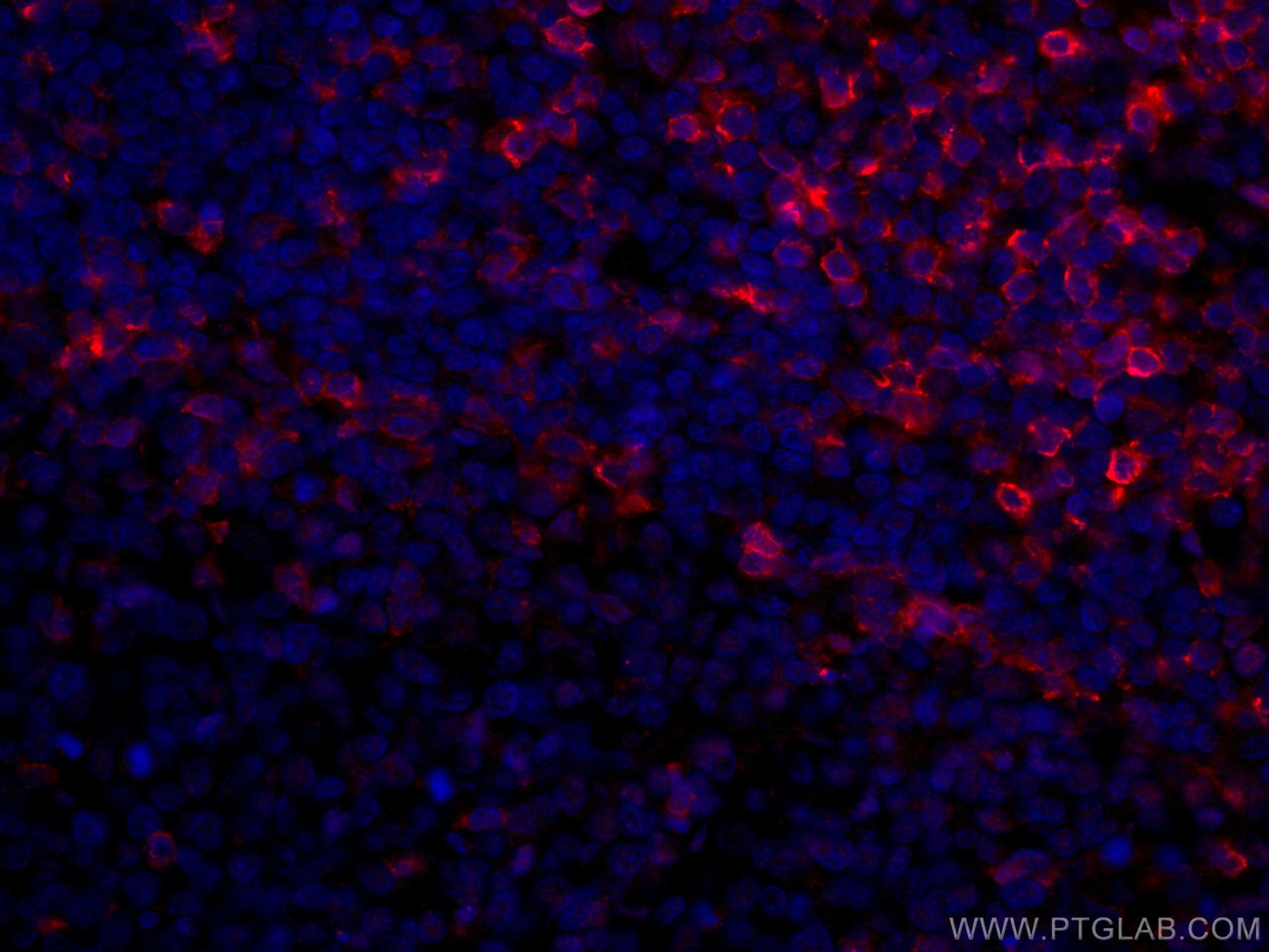 Immunofluorescence (IF) / fluorescent staining of human tonsillitis tissue using CoraLite®594-conjugated CD5 Monoclonal antibody (CL594-67278)