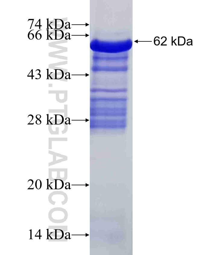 CD5 fusion protein Ag11065 SDS-PAGE