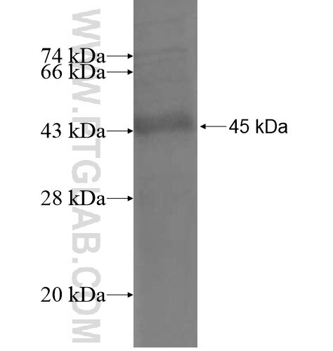 CD5 fusion protein Ag11097 SDS-PAGE
