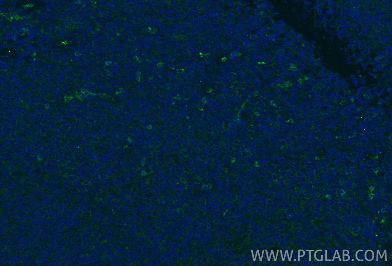 IF Staining of human tonsillitis using 21809-1-AP Immunofluorescence (IF) / fluorescent staining of human tonsillitis tissue using CD52 Polyclonal antibody (21809-1-AP)