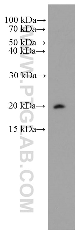 Western Blot (WB) analysis of human spleen tissue using CD52 Monoclonal antibody (66784-1-Ig)