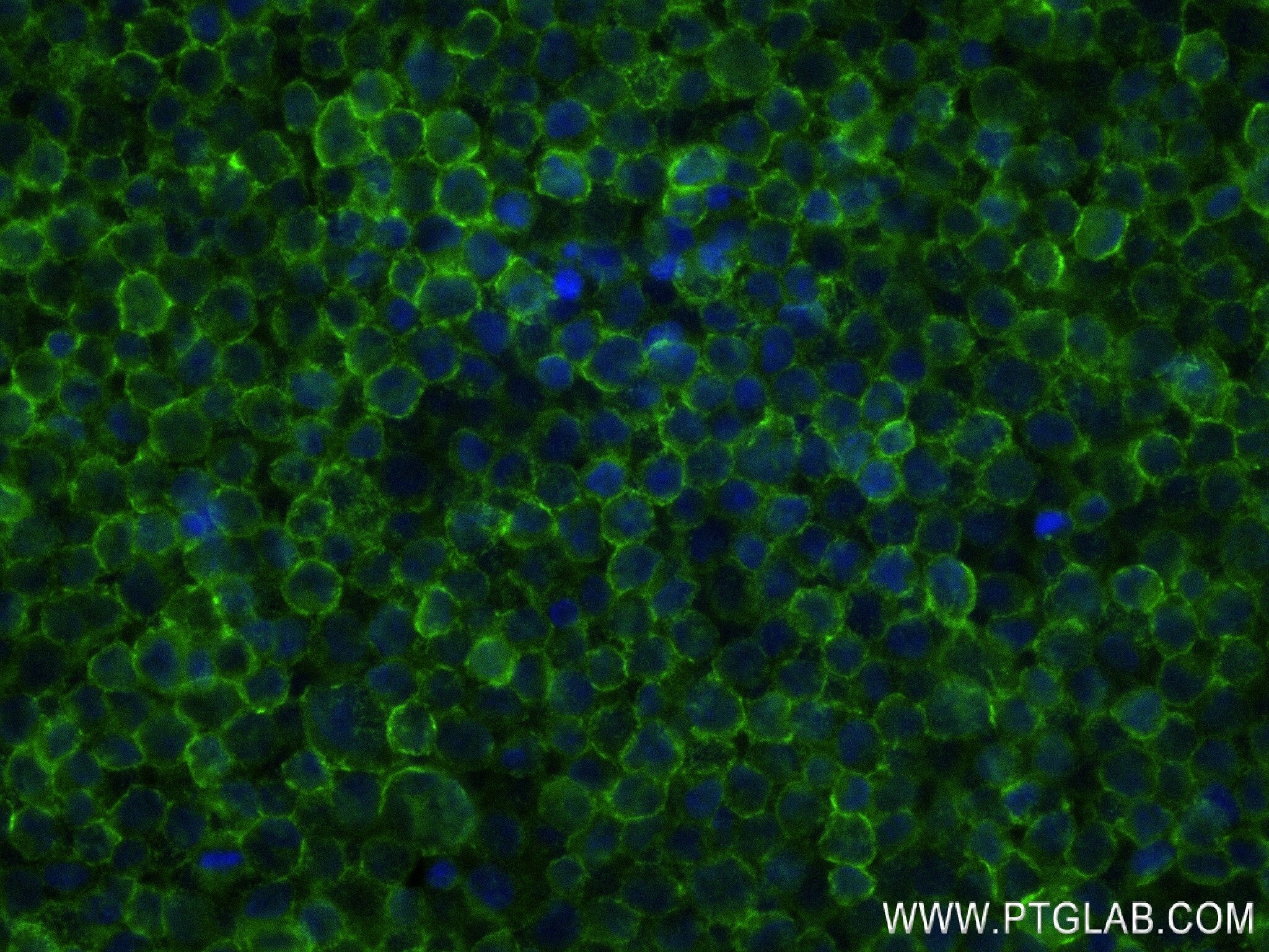 Immunofluorescence (IF) / fluorescent staining of Daudi cells using CD53 Recombinant antibody (84837-1-RR)