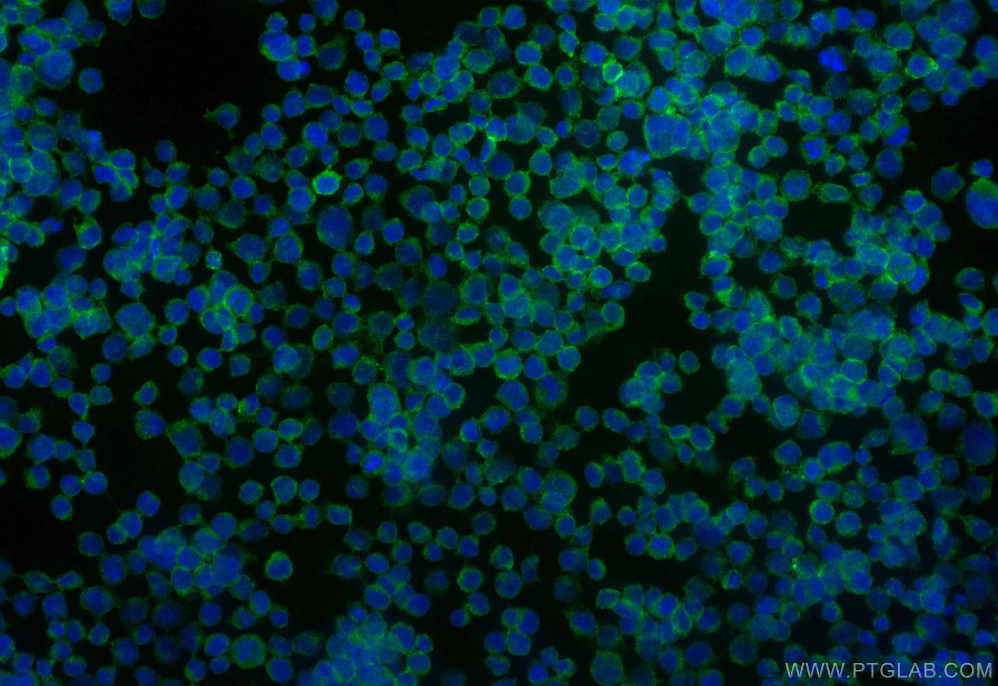 Immunofluorescence (IF) / fluorescent staining of Jurkat cells using CD53 Recombinant antibody (84837-1-RR)