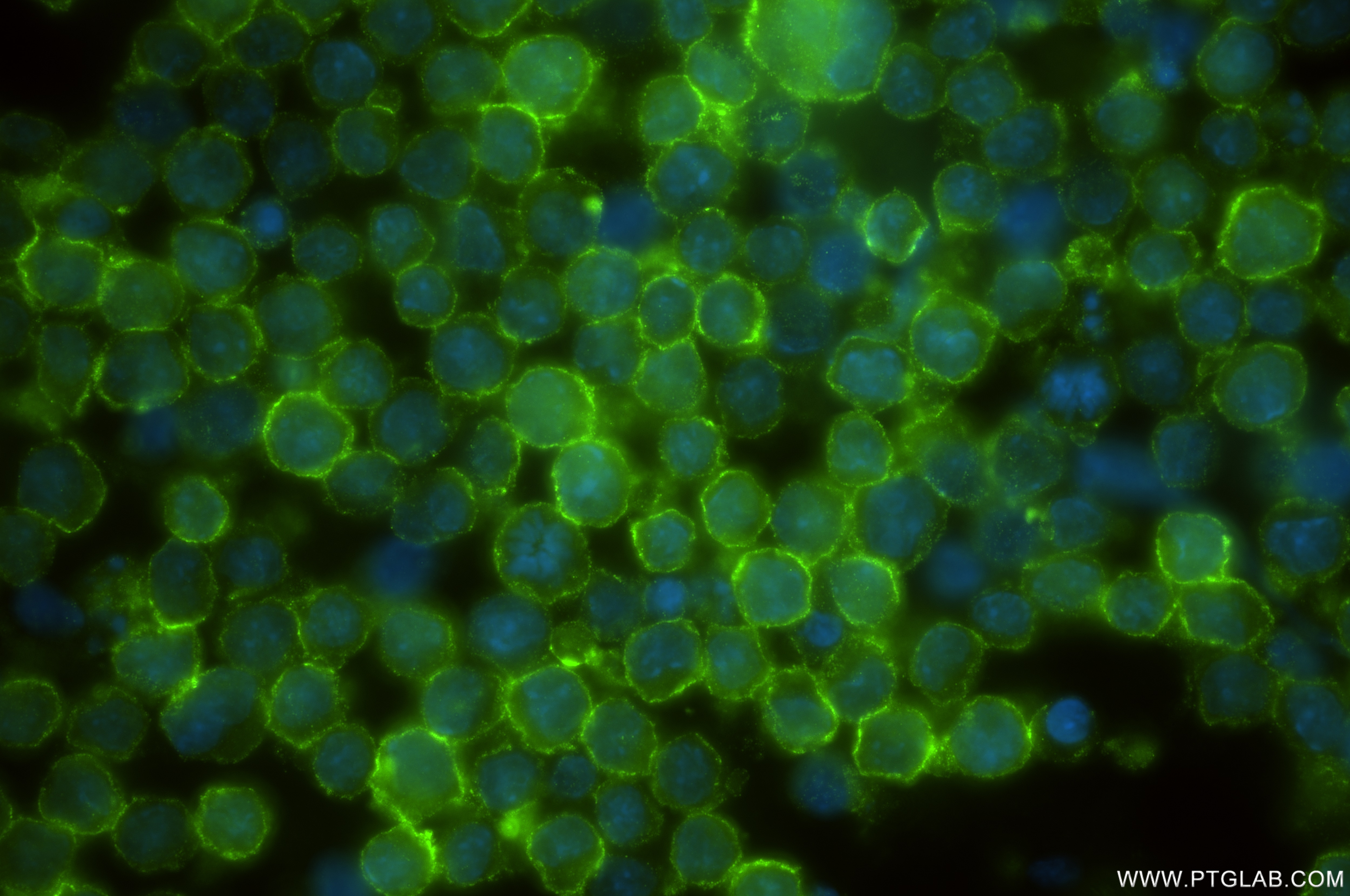 Immunofluorescence (IF) / fluorescent staining of A20 cells using CD53 Recombinant antibody (85838-3-RR)