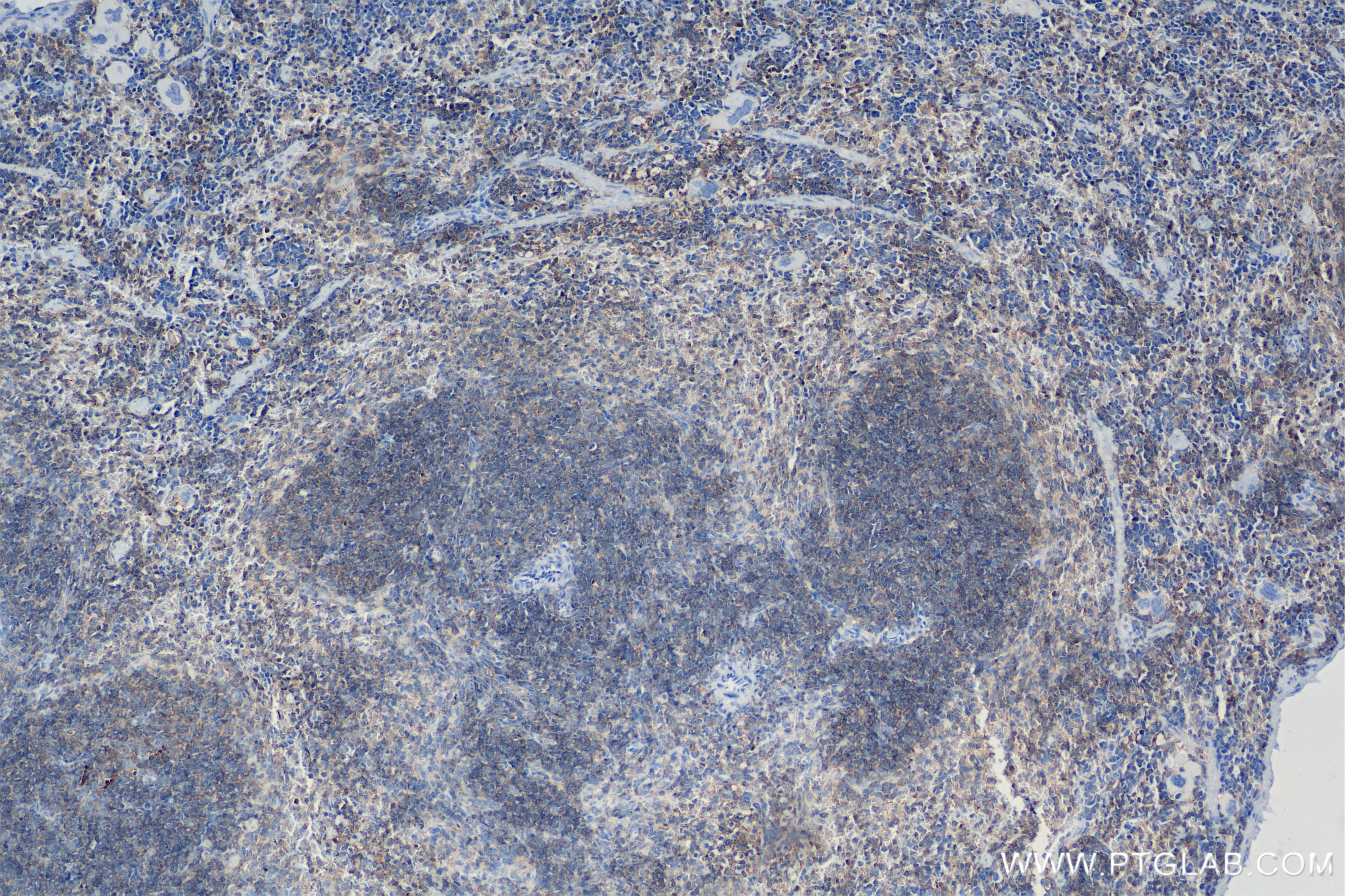 Immunohistochemistry (IHC) staining of mouse spleen tissue using CD53 Recombinant antibody (85838-3-RR)