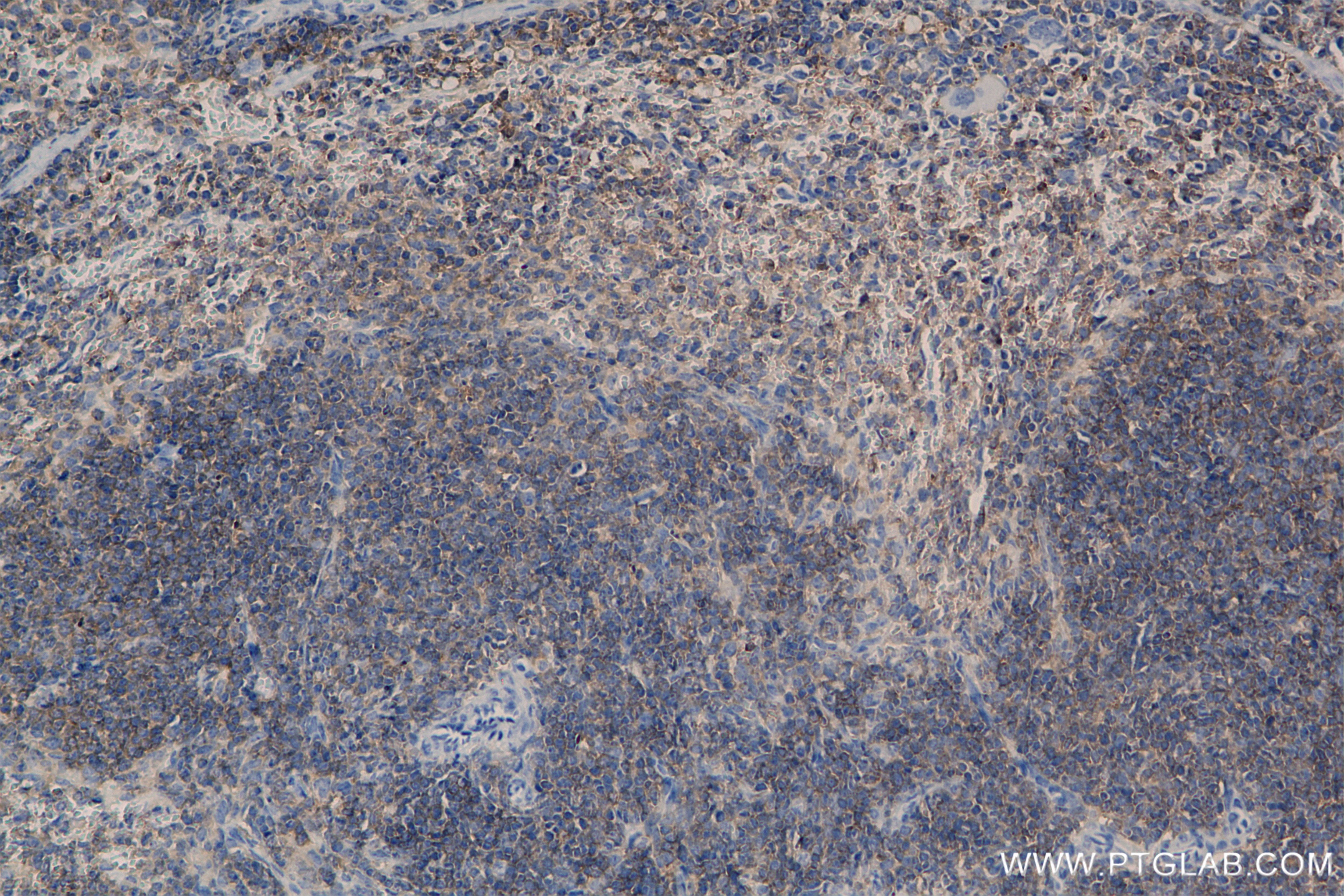 Immunohistochemistry (IHC) staining of mouse spleen tissue using CD53 Recombinant antibody (85838-3-RR)