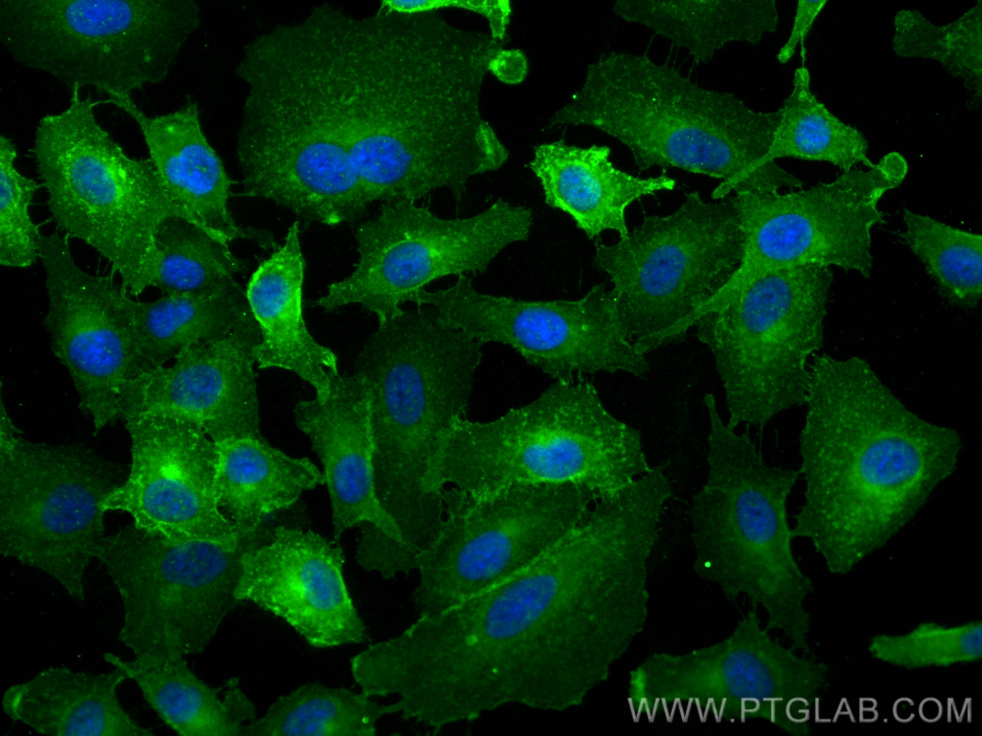 Immunofluorescence (IF) / fluorescent staining of A549 cells using CD55 Polyclonal antibody (26580-1-AP)