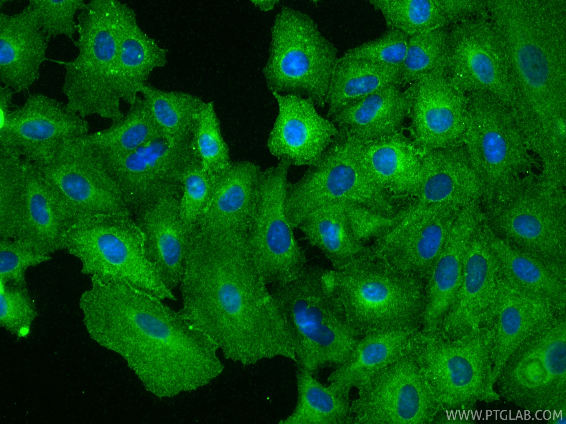 Immunofluorescence (IF) / fluorescent staining of A549 cells using CD55 Polyclonal antibody (26580-1-AP)
