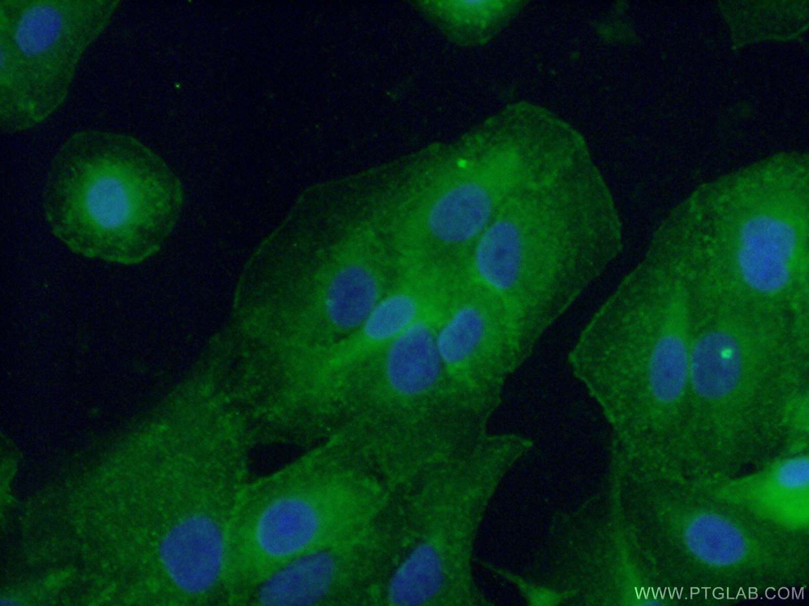 Immunofluorescence (IF) / fluorescent staining of A549 cells using CD55 Polyclonal antibody (26580-1-AP)