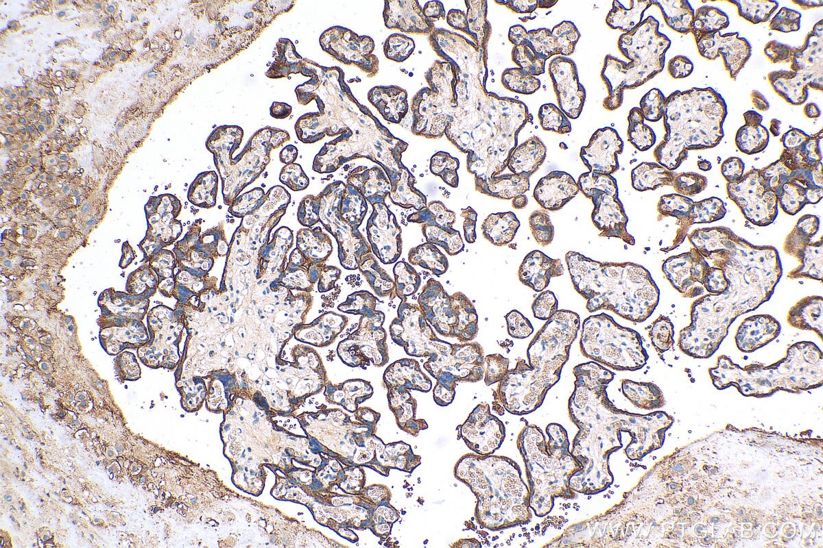 Immunohistochemistry (IHC) staining of human placenta tissue using CD55 Polyclonal antibody (26580-1-AP)