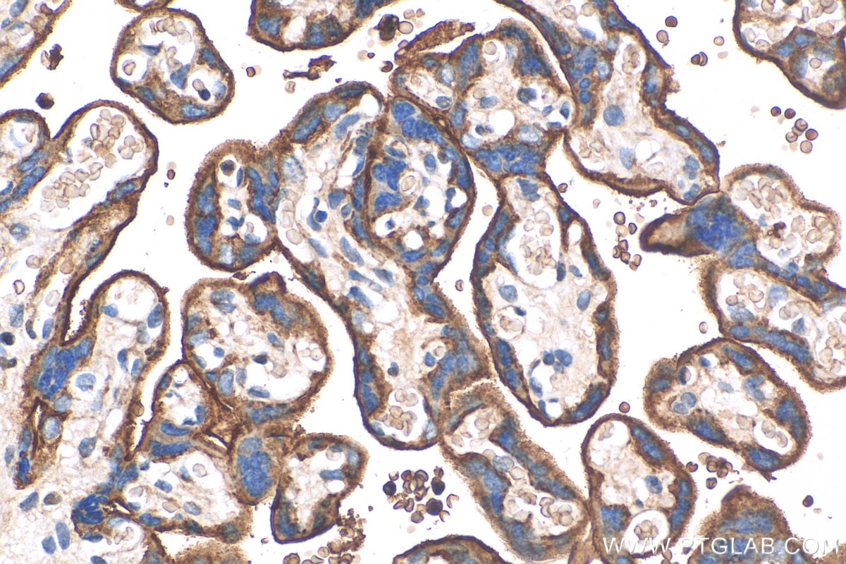 Immunohistochemistry (IHC) staining of human placenta tissue using CD55 Polyclonal antibody (26580-1-AP)