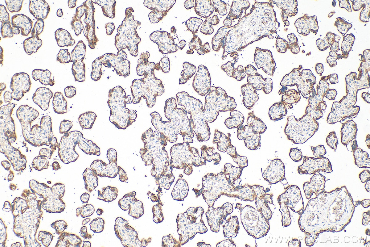 Immunohistochemistry (IHC) staining of human placenta tissue using CD55 Polyclonal antibody (26580-1-AP)