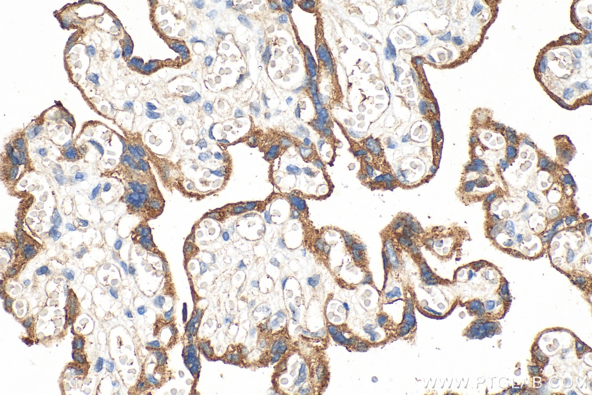 Immunohistochemistry (IHC) staining of human placenta tissue using CD55 Polyclonal antibody (26580-1-AP)