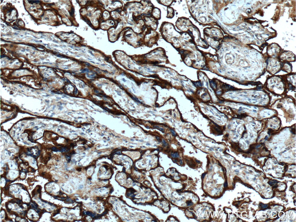 Immunohistochemistry (IHC) staining of human placenta tissue using CD55 Polyclonal antibody (26580-1-AP)