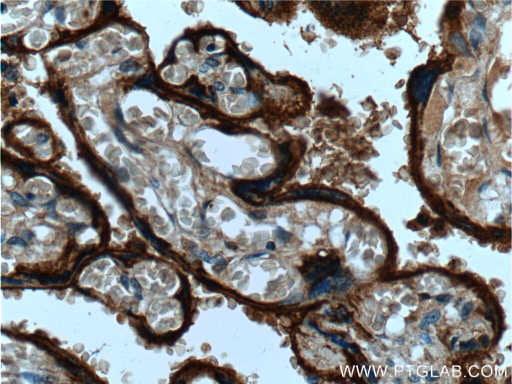 Immunohistochemistry (IHC) staining of human placenta tissue using CD55 Polyclonal antibody (26580-1-AP)