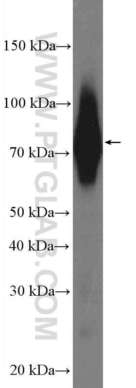 Western Blot (WB) analysis of human placenta tissue using CD55 Polyclonal antibody (26580-1-AP)