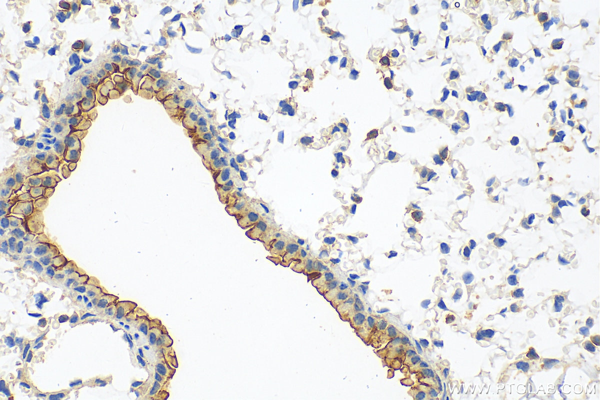 Immunohistochemistry (IHC) staining of mouse lung tissue using CD55 Polyclonal antibody (32061-1-AP)