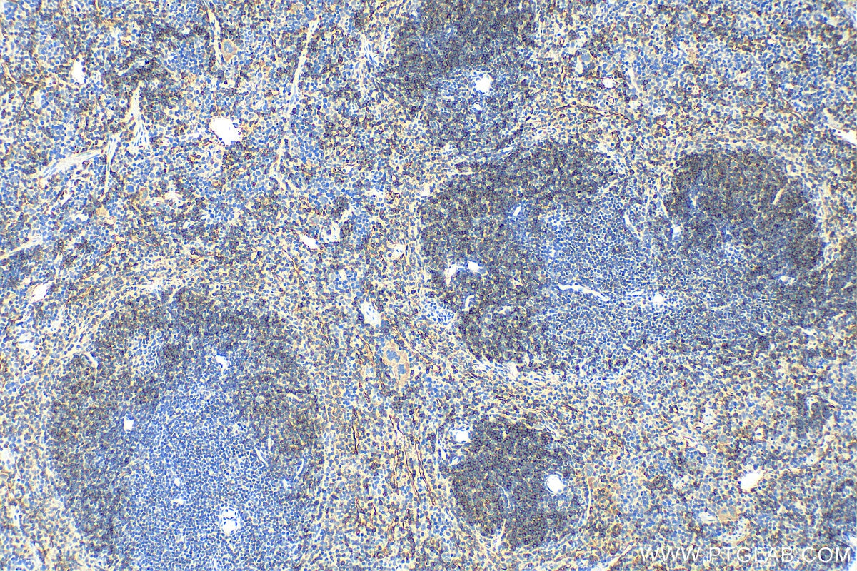 Immunohistochemistry (IHC) staining of mouse spleen tissue using CD55 Polyclonal antibody (32061-1-AP)