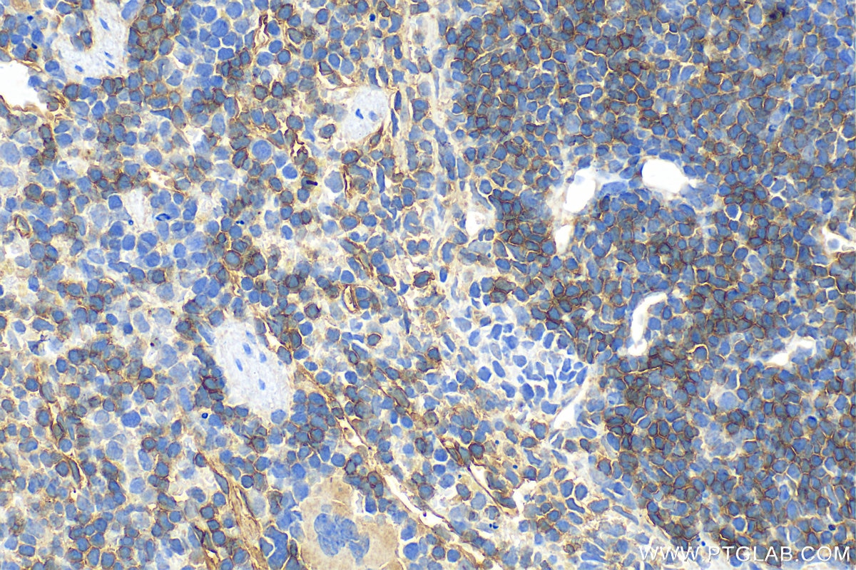 Immunohistochemistry (IHC) staining of mouse spleen tissue using CD55 Polyclonal antibody (32061-1-AP)