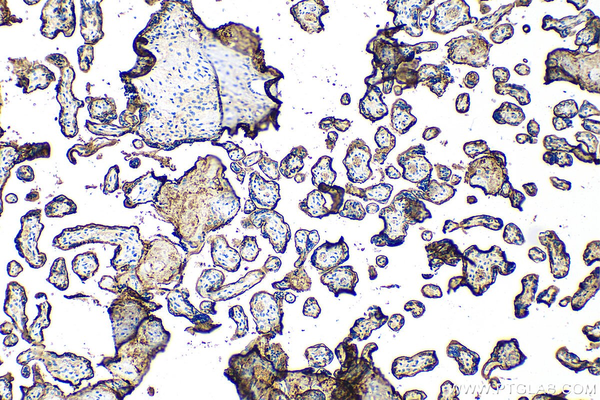 Immunohistochemistry (IHC) staining of human placenta tissue using CD55 Recombinant antibody (82781-6-RR)