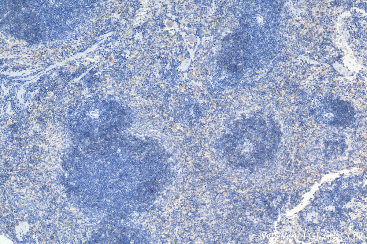 Immunohistochemistry (IHC) staining of mouse spleen tissue using CD55 Recombinant antibody (84519-6-RR)