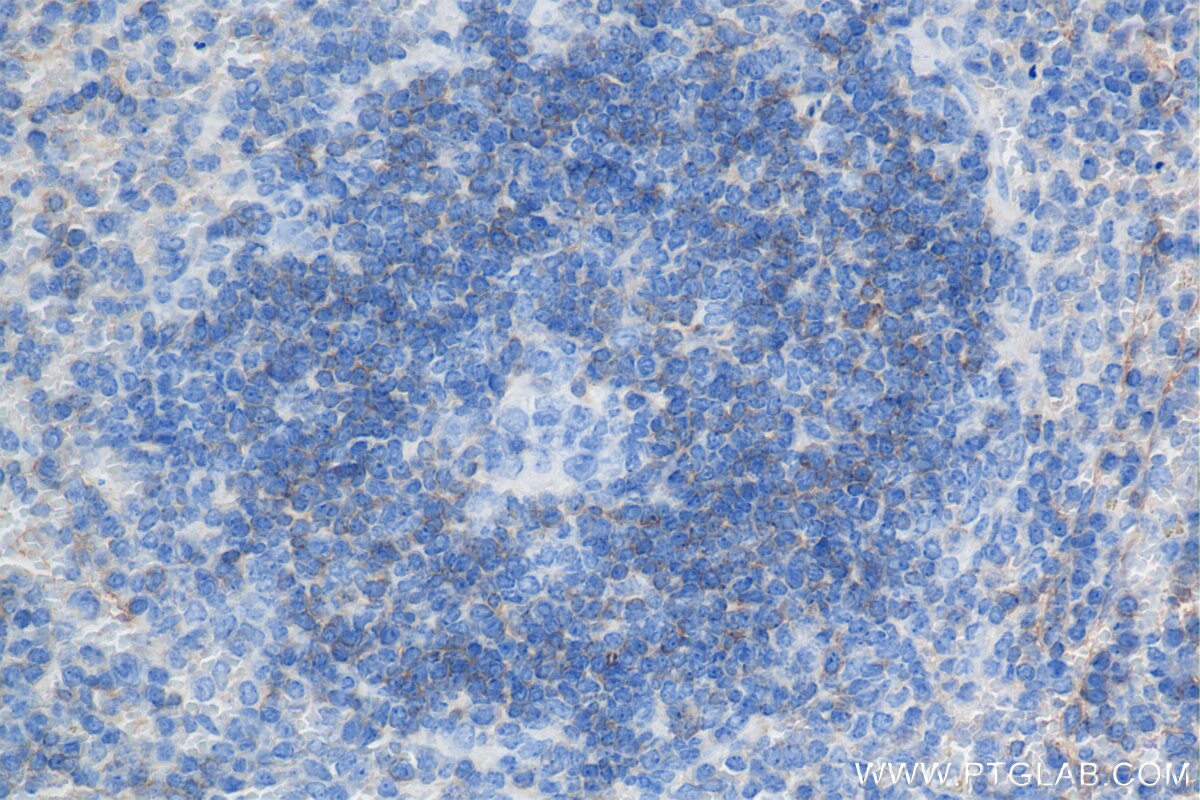 Immunohistochemistry (IHC) staining of mouse spleen tissue using CD55 Recombinant antibody (84519-6-RR)