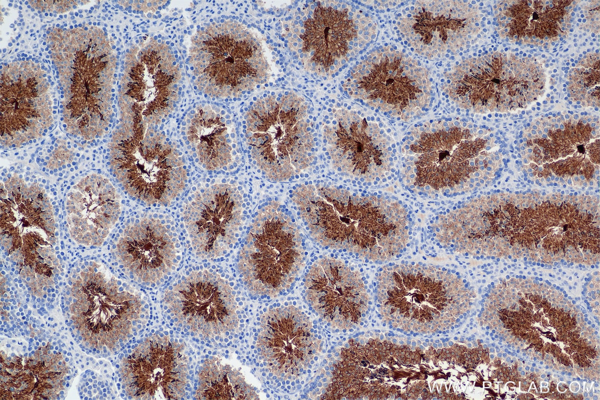 Immunohistochemistry (IHC) staining of mouse testis tissue using CD55 Recombinant antibody (84519-6-RR)