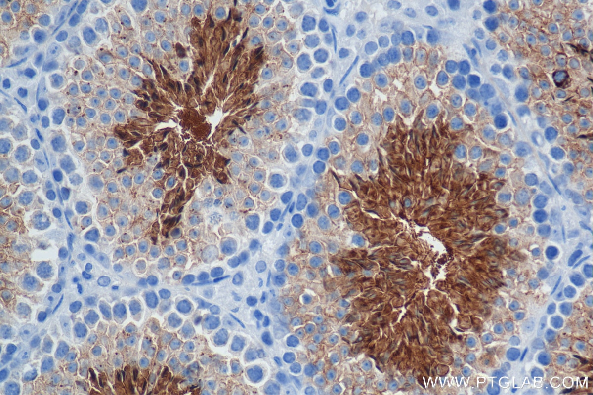 Immunohistochemistry (IHC) staining of mouse testis tissue using CD55 Recombinant antibody (84519-6-RR)